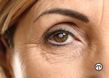 Lo que usted necesita saber sobre las cataratas