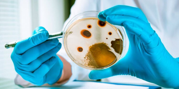 Alertan de contaminación por listeria de leche cruda en el condado de Saratoga